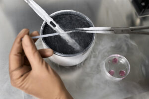 best Cryopreservation treatment in Mumbai